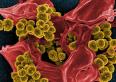 メチシリン耐性ブドウ球菌（黄色）とヒト白血球の死骸（赤色）／出典：NIH（米国立衛生研究所）／https://bit.ly/2Kd4Ck5