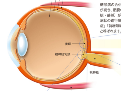 目の病気の仕組み（糖尿病網膜症／網膜静脈閉塞症／網膜剥離）