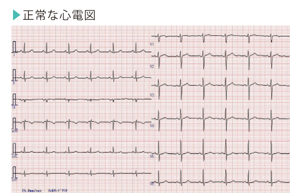 図解-正常な心電図